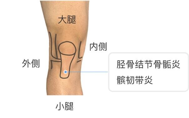 膝蓋各個部位疼痛圖解，不同位置疼痛代表不同疾病(兩側(cè)疼最嚴(yán)重)