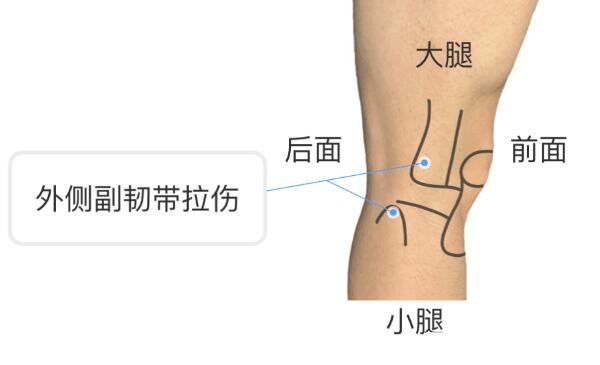 膝蓋各個部位疼痛圖解，不同位置疼痛代表不同疾病(兩側(cè)疼最嚴(yán)重)