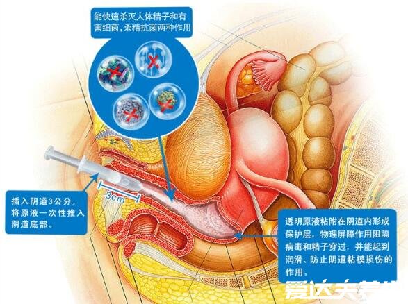 液體避孕套使用方法圖解，注射后無(wú)需戴套體驗(yàn)感完全不同