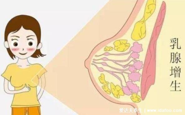 乳腺增生的癥狀有哪些癥狀，乳房有腫塊疼痛/乳頭有溢液(圖片)