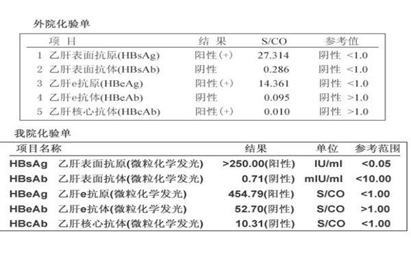 乙肝五項(xiàng)正常結(jié)果圖，三項(xiàng)指標(biāo)呈陽(yáng)性說(shuō)明了什么