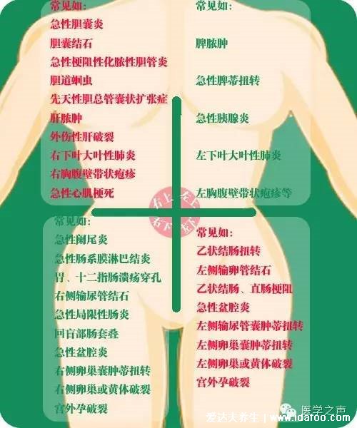 女性下腹疼痛部位圖解，右下腹疼痛是闌尾炎