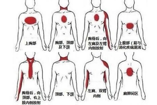 左后背疼圖片位置示意圖，可能是心臟出了問題