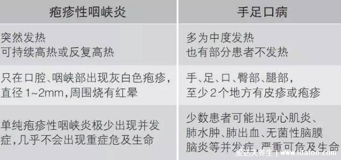 小兒皰疹性咽峽炎最早期圖片，只在口腔/咽頰有灰白色皰疹(手足口病相似)