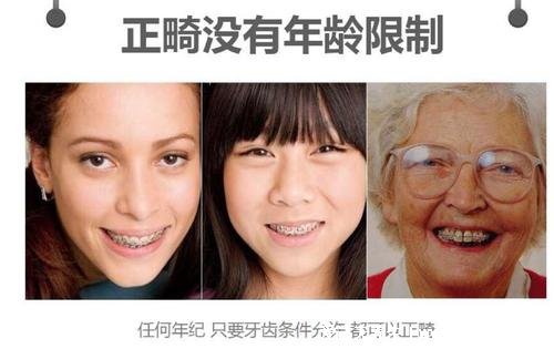 成年以后千萬別整牙，因?yàn)槟銜?huì)后悔一時(shí)（但是幸福一輩子）