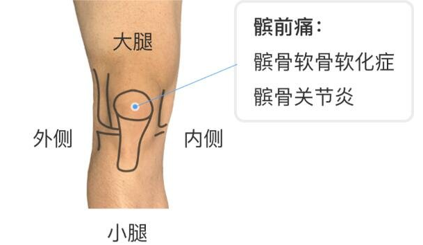 髕骨是哪個部位圖片，人膝蓋各個部位疼痛圖解(膝蓋正中心)