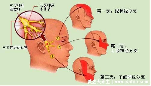 身體各部位疼痛對(duì)照?qǐng)D，包括腹部/腰部/背部疼(左上腹小心胃病)