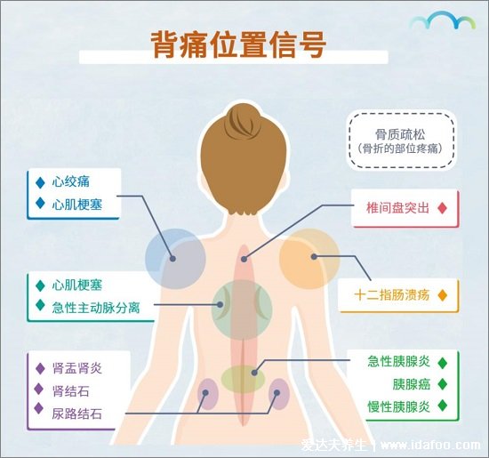 身體各部位疼痛對(duì)照?qǐng)D，包括腹部/腰部/背部疼(左上腹小心胃病)