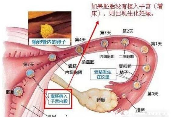 生化妊娠排出蛻膜圖片，會(huì)有子宮內(nèi)膜脫落像來(lái)月經(jīng)一樣