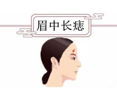 女人身上的10大福痣少見的極富貴痣，屁股有痣財運事業(yè)佳