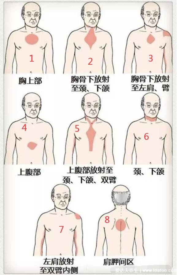 人體器官后背疼痛對應(yīng)器官圖，9處致命的心臟疼痛位置圖