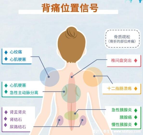 人體器官后背疼痛對應(yīng)器官圖，9處致命的心臟疼痛位置圖