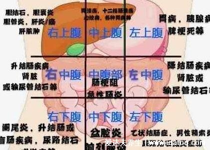 闌尾炎是哪個部位疼位置示意圖片，右下腹按壓痛(早期上腹肚臍疼)