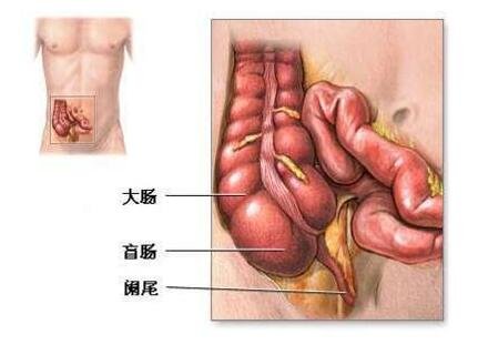 女性闌尾炎的疼痛位置圖片，會轉(zhuǎn)移性右下腹按壓痛(剛開始上腹肚臍疼)