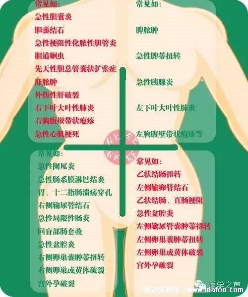 女性闌尾炎的疼痛位置圖片，會轉(zhuǎn)移性右下腹按壓痛(剛開始上腹肚臍疼)