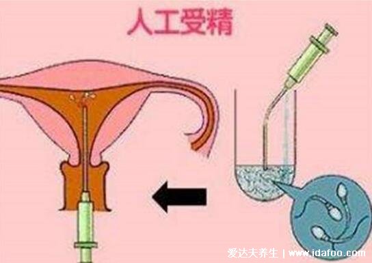 人工助孕方法有哪些，3種方法幫你順利懷上小寶寶