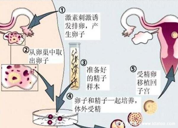 人工授精的過(guò)程與費(fèi)用，檢查費(fèi)用開(kāi)始算起3000到5000元(附過(guò)程圖)