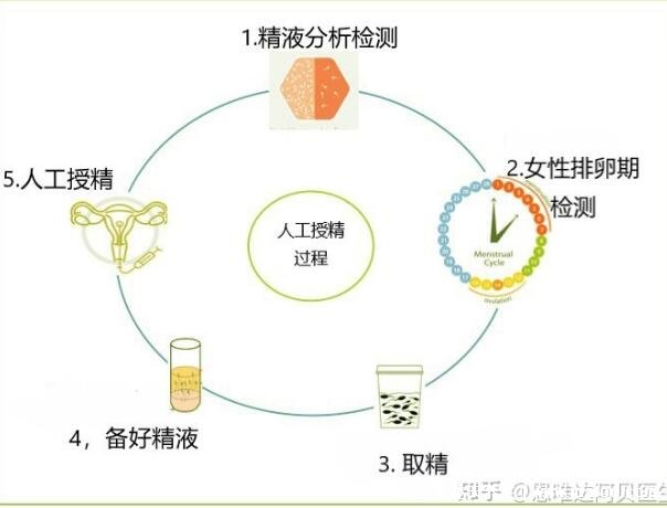 人工授精的過(guò)程與費(fèi)用，檢查費(fèi)用開(kāi)始算起3000到5000元(附過(guò)程圖)