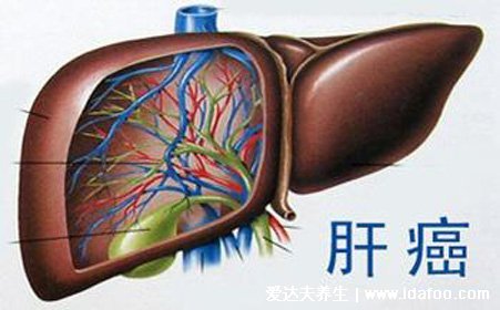 四種癌已經不是癌了，含宮頸癌/乳腺癌/前列腺癌(附5年生存率)