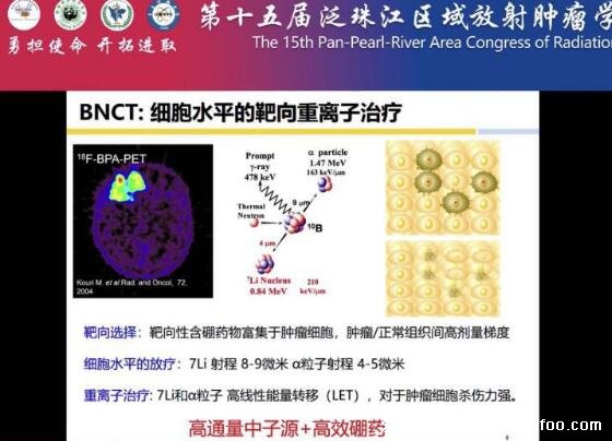 硼中子可以治療哪些腫瘤，有效治療頭頸部腫瘤等多種癌癥