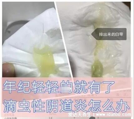 怎么判斷霉菌還是滴蟲圖片，霉菌豆腐渣樣白帶很瘙癢