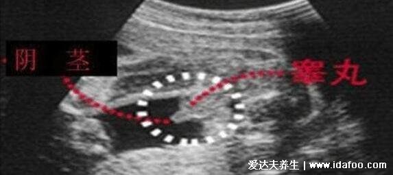 小方法知道自己懷的男孩女孩，10秒測(cè)出懷男孩和女孩