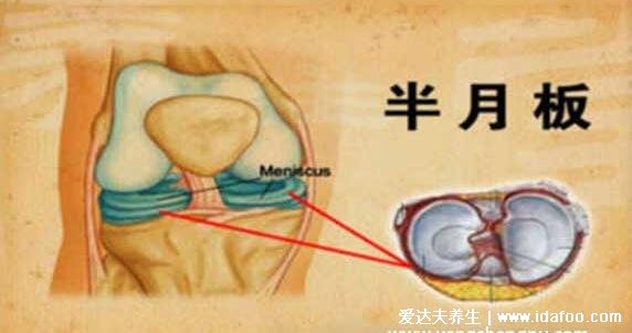 半月板是什么部位圖片，位于膝關(guān)節(jié)的內(nèi)外兩側(cè)起緩沖作用