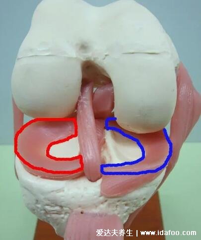半月板是什么部位圖片，位于膝關(guān)節(jié)的內(nèi)外兩側(cè)起緩沖作用