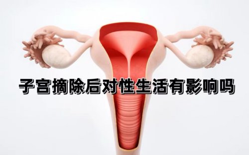 女人子宮摘除手術(shù)后對性生活有影響嗎