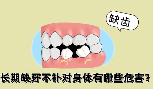 缺牙有害健康長(zhǎng)期缺牙不補(bǔ)能給身體帶來(lái)7大危害