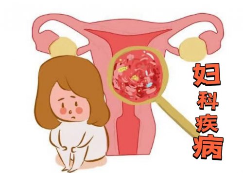 女性深受婦科病騷擾多半與這5個(gè)習(xí)慣有關(guān)需盡早改掉