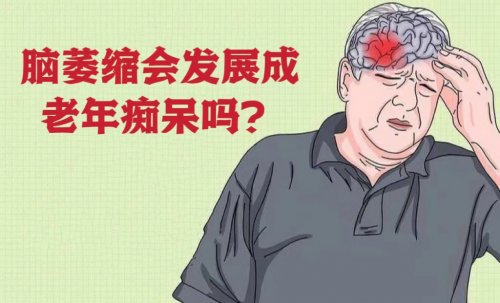 引發(fā)腦萎縮的原因是什么腦萎縮會發(fā)展成老年癡呆嗎