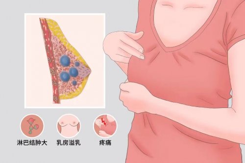 呵護(hù)乳房健康消除乳腺結(jié)節(jié)從日常做起