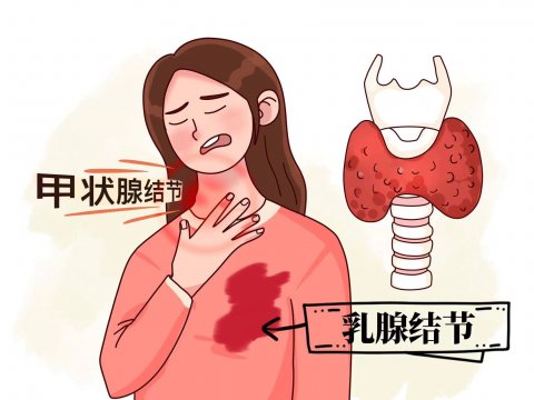 甲狀腺和乳腺為什么經(jīng)常一起長結(jié)節(jié)